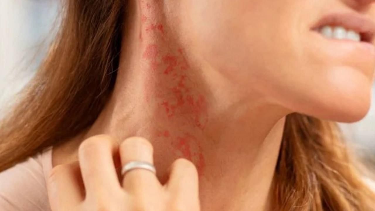 Removing fiberglass from skin (Image via YouTube)